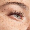 Freckle Face